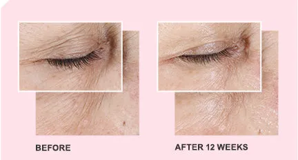 Mary Kay TimeWise Miracle Set 3D®