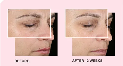 Mary Kay TimeWise Miracle Set 3D®